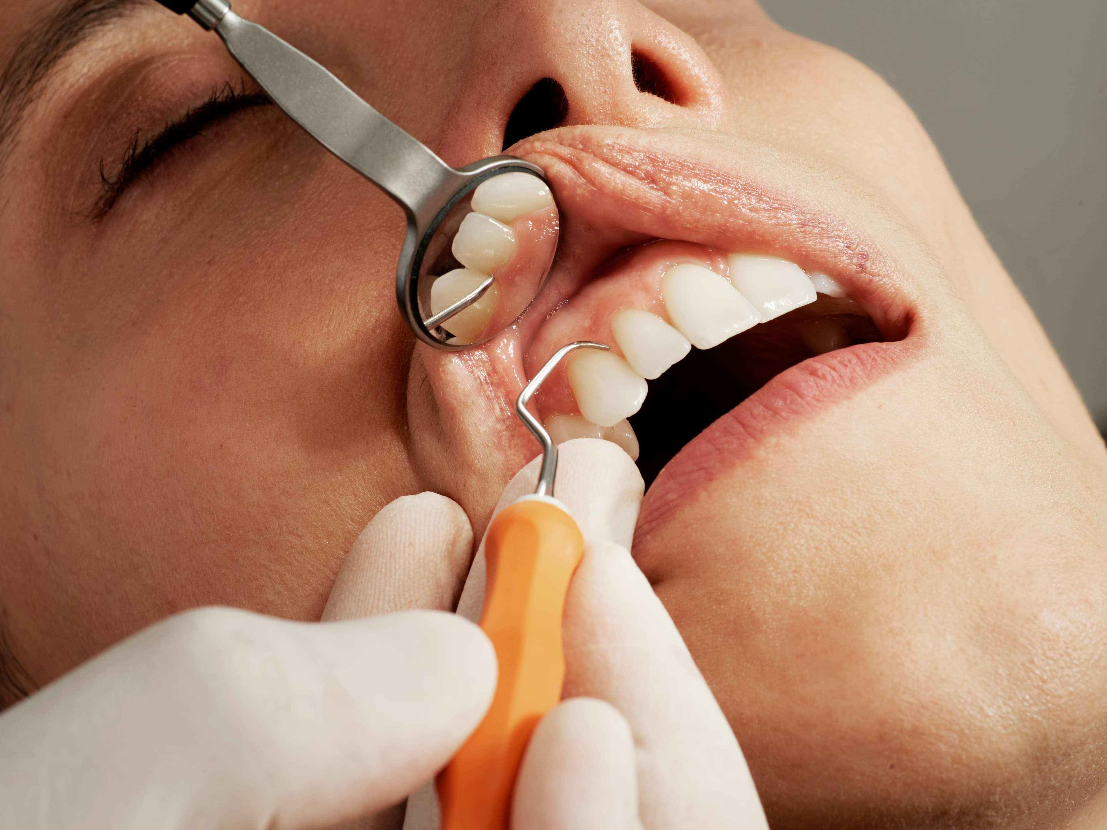 Dental Health Screening